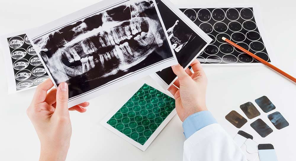 Cirugía Maxilofacial