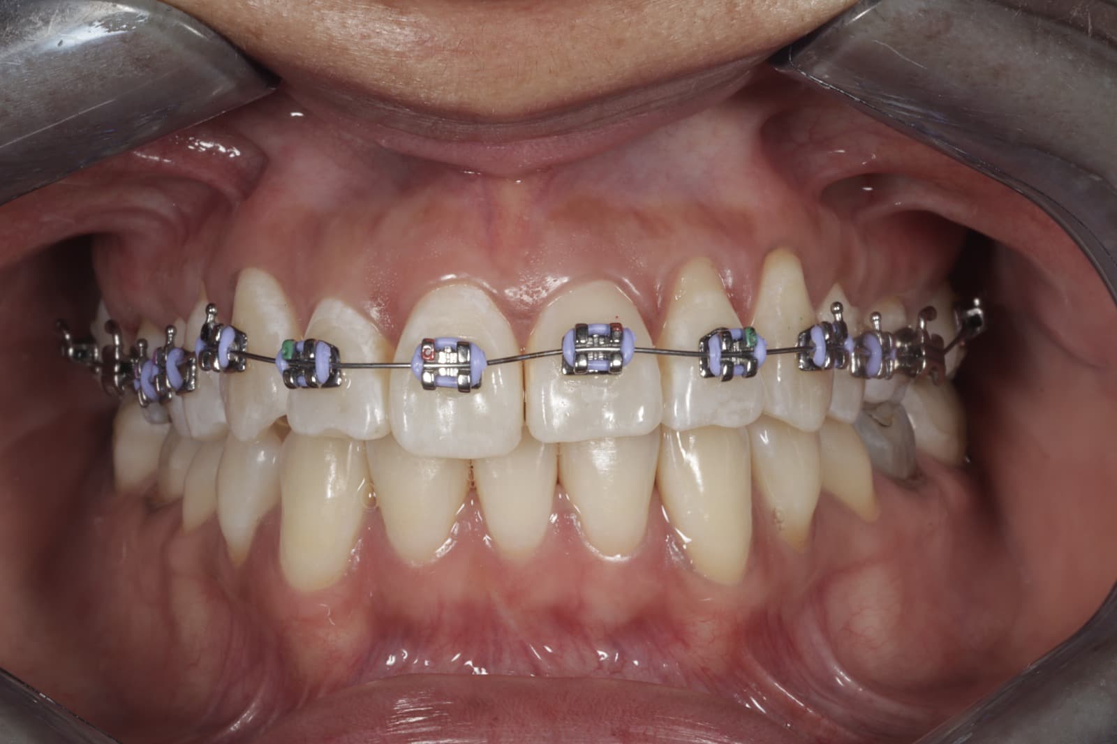 Ortodoncia Especializada