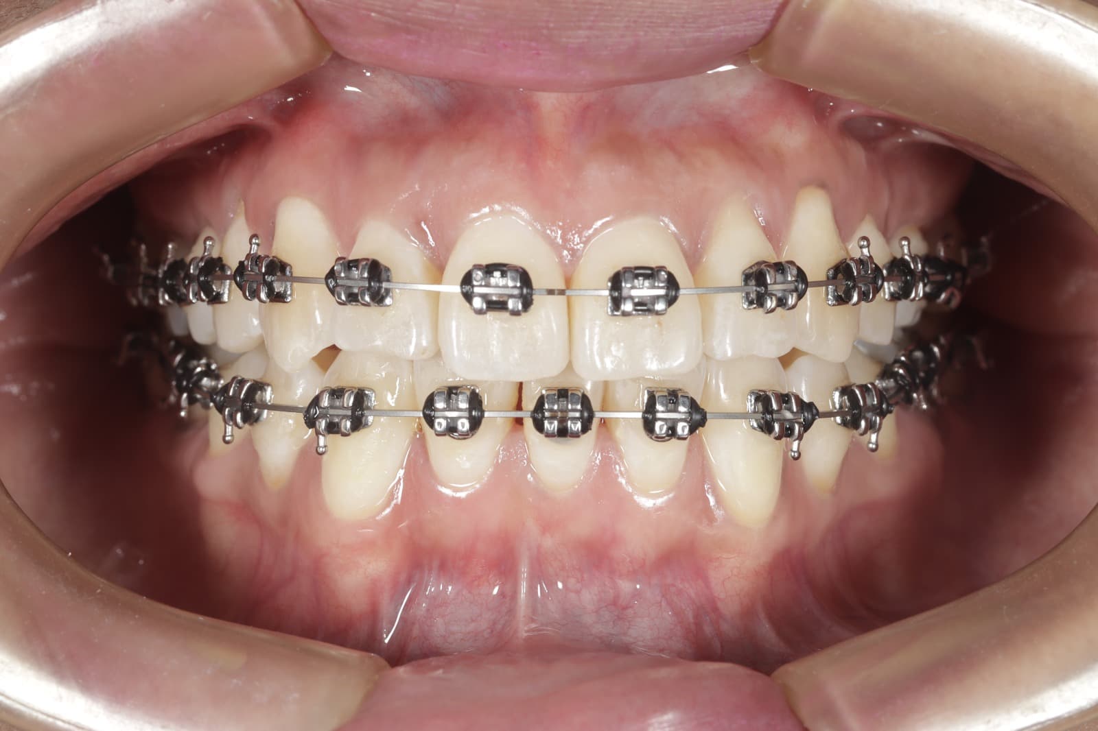 Ortodoncia Especializada